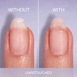 Comparison of a fingernail with and without a repair on a purple background