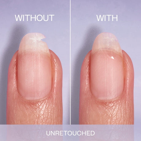 Comparison of a fingernail with and without a repair on a purple background